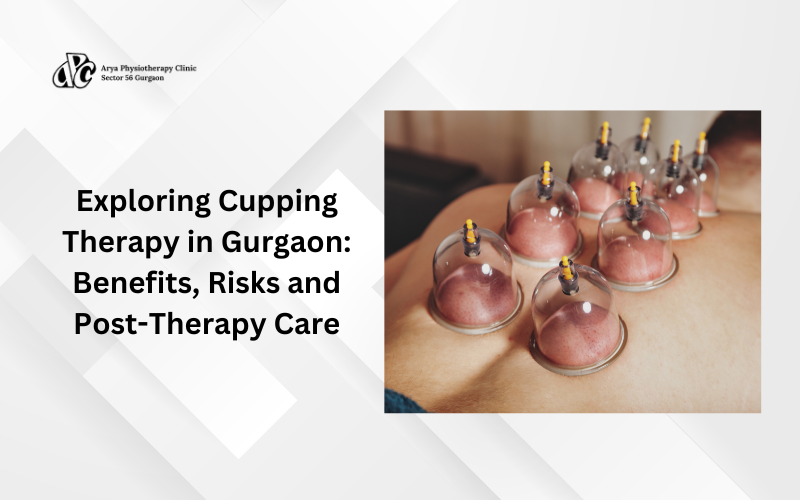 Cupping Therapy